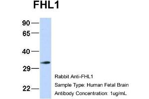Host: Rabbit Target Name: FHL1 Sample Type: Human Fetal Brain Antibody Dilution: 1. (FHL1 antibody  (N-Term))