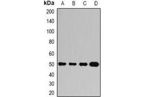 Western blot analysis of Ataxin 3 expression in Jurkat (A), A549 (B), mouse brain (C), mouse liver (D) whole cell lysates. (Ataxin 3 antibody)
