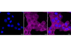 Immunocytochemical staining of HT- cells with MLD antibody (ABIN7799509), 1:1,000).