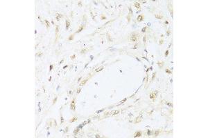 Immunohistochemistry (Paraffin-embedded Sections) (IHC (p)) image for anti-Signal Transducer and Activator of Transcription 1, 91kDa (STAT1) (AA 650-750) antibody (ABIN6148563)