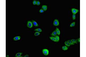 Immunofluorescent analysis of HepG2 cells using ABIN7172305 at dilution of 1:100 and Alexa Fluor 488-congugated AffiniPure Goat Anti-Rabbit IgG(H+L) (TOR1A antibody  (AA 88-125))