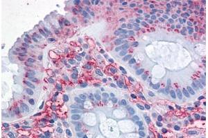 Human Colon: Formalin-Fixed, Paraffin-Embedded (FFPE) (SLC1A5 antibody  (Internal Region))