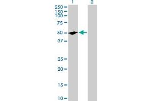 Western Blot analysis of RUNDC3A expression in transfected 293T cell line by RUNDC3A MaxPab polyclonal antibody. (RUNDC3A antibody  (AA 1-405))