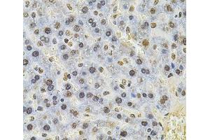 Immunohistochemistry of paraffin-embedded Rat liver using PSMC3 Polyclonal Antibody at dilution of 1:100 (40x lens). (PSMC3 antibody)