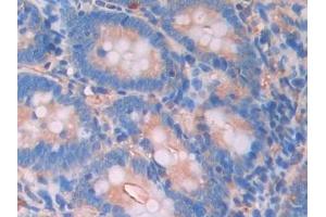 Detection of LCAT in Rat Small intestine Tissue using Polyclonal Antibody to Lecithin Cholesterol Acyltransferase (LCAT) (LCAT antibody  (AA 41-210))