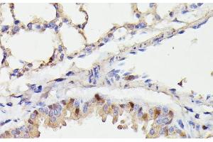 Immunohistochemistry of paraffin-embedded Mouse lung using CDC23 Polyclonal Antibody at dilution of 1:100 (40x lens).