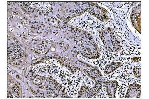 IHC analysis of JAB1 using anti-JAB1 antibody (ABIN7602482).