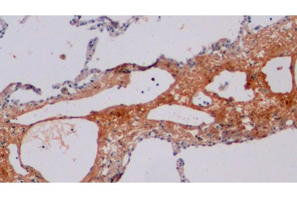 CTX-I antibody
