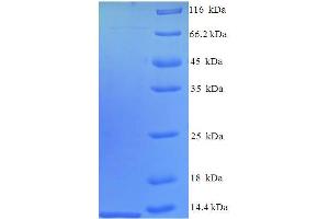 SDS-PAGE (SDS) image for Chemokine (C-C Motif) Ligand 12 (Ccl12) (AA 23-104) protein (His tag) (ABIN5712658) (Ccl12 Protein (AA 23-104) (His tag))