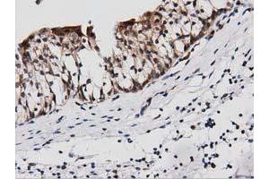 Immunohistochemical staining of paraffin-embedded Human liver tissue using anti-PEPD mouse monoclonal antibody.