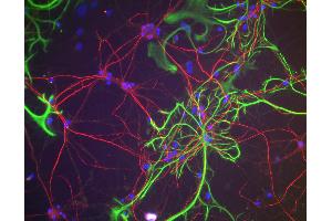 Immunofluorescence of rat cortical neurons and glia showing NF-H staining (red).