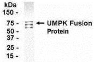 Western Blotting (WB) image for anti-Uridine-Cytidine Kinase 2 (UCK2) (AA 1-261) antibody (ABIN2468114) (UCK2 antibody  (AA 1-261))