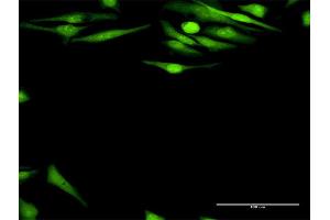 Immunofluorescence (IF) image for anti-DNA Fragmentation Factor, 45kDa, alpha Polypeptide (DFFA) (AA 1-331) antibody (ABIN514954)