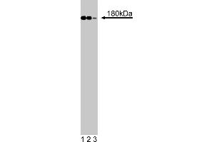 Western Blotting (WB) image for anti-Insulin Receptor Substrate 1 (IRS1) (AA 1131-1234) antibody (ABIN968515) (IRS1 antibody  (AA 1131-1234))