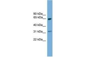 Image no. 1 for anti-Protein Inhibitor of Activated STAT, 2 (PIAS2) (AA 81-130) antibody (ABIN6744670) (PIAS2 antibody  (AA 81-130))