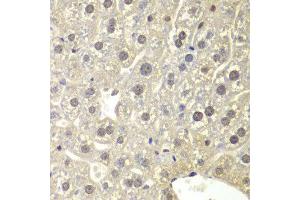 Immunohistochemistry (IHC) image for anti-Nuclear Receptor Subfamily 3, Group C, Member 1 (Glucocorticoid Receptor) (NR3C1) (AA 1-280) antibody (ABIN6219384) (Glucocorticoid Receptor antibody  (AA 1-280))