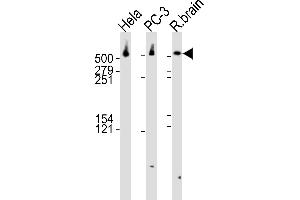 Western blot analysis of lysates from Hela, PC-3 cell line and rat brain tissue lysate(from left to right), using DYNC1H1 Antibody (C-term) (ABIN6242986 and ABIN6577559). (DYNC1H1 antibody  (C-Term))
