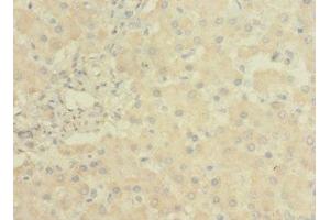 Immunohistochemistry of paraffin-embedded human liver tissue using ABIN7158162 at dilution of 1:100 (LRRC31 antibody  (AA 1-300))