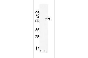 Western blot analysis of TIEG (arrow) using rabbit polyclonal TIEG Antibody (Center) (ABIN655153 and ABIN2844772). (KLF10/TIEG1 antibody  (AA 198-225))