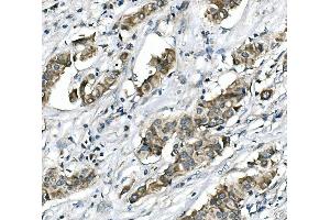 IHC analysis of RICTOR using anti-RICTOR antibody (ABIN7600744).