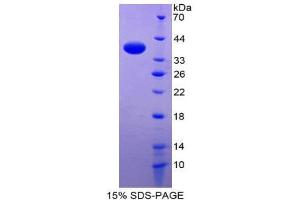 SDS-PAGE (SDS) image for Phospholamban (PLN) (AA 1-52) protein (His tag,GST tag) (ABIN2123466) (Phospholamban Protein (PLN) (AA 1-52) (His tag,GST tag))