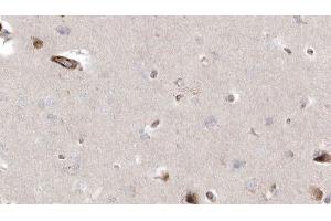 ABIN6272940 at 1/100 staining Human brain cancer tissue by IHC-P. (CISD2 antibody  (Internal Region))