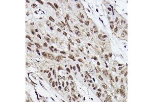 Immunohistochemistry (IHC) image for anti-Ubiquitin-Conjugating Enzyme E2B (UBE2B) antibody (ABIN7271173)