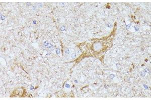 Immunohistochemistry of paraffin-embedded Mouse spinal cord using TBCA Polyclonal Antibody at dilution of 1:100 (40x lens). (TBCA antibody)