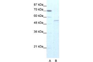 WB Suggested Anti-ZNF665 Antibody Titration:  5.