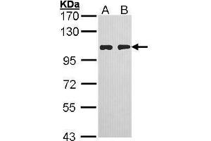 WB Image Sample (30 ug of whole cell lysate) A: H1299 B: Hela 7. (HGS antibody  (C-Term))