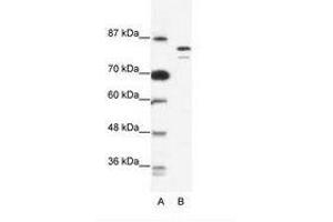 Image no. 1 for anti-Minichromosome Maintenance Deficient 8 (MCM8) (AA 144-193) antibody (ABIN203257) (MCM8 antibody  (AA 144-193))