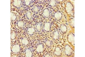 Immunohistochemistry of paraffin-embedded human colon tissue using ABIN7174792 at dilution of 1:100 (C1ORF53 antibody  (AA 1-145))