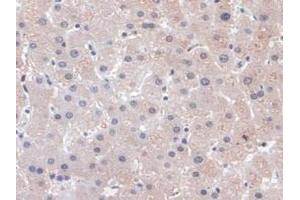 Detection of PLCB1 in Human Liver Tissue using Polyclonal Antibody to Phospholipase C Beta 1 (PLCB1) (Phospholipase C beta 1 antibody  (AA 316-476))