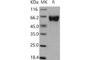 Western Blotting (WB) image for GDNF Family Receptor alpha 1 (GFRA1) (Active) protein (His tag) (ABIN7195911) (GFRA1 Protein (His tag))