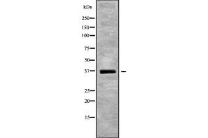 Western blot analysis of DNAJB2 using HUVEC whole cell lysates (DNAJB2 antibody  (Internal Region))