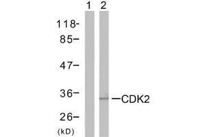 Western blot analysis of the extracts from A2780 cells using CDK2 (Ab-160) antibody (E021111). (CDK2 antibody)