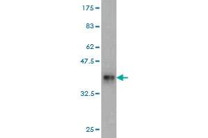 Western Blot detection against Immunogen (36. (RPL18 antibody  (AA 90-188))