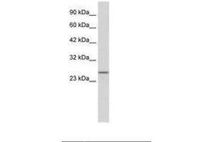 Image no. 1 for anti-SRY (Sex Determining Region Y)-Box 14 (SOX14) (AA 64-113) antibody (ABIN202107) (SOX14 antibody  (AA 64-113))