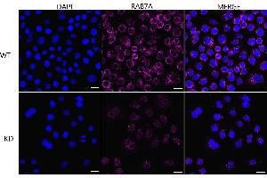 Immunocytochemical staining of HeLa cells using RAB7A antibody (ABIN7800103), 1:1,000), Top panel: wild-type (WT), Bottom panal: RAB7A shRNA knockdown (KD).