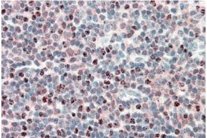 AP23684PU-N PSMB10 Antibody (5µg/ml) staining of paraffin embedded Human Tonsil.