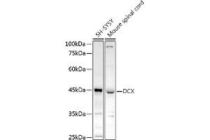 Western blot analysis of extracts of various cell lines, using DCX antibody (ABIN3021509, ABIN3021510, ABIN3021511 and ABIN6215166) at 1:1000 dilution. (Doublecortin antibody  (AA 11-360))