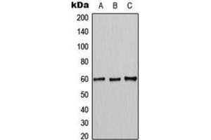 Western blot analysis of MUTYH expression in K562 (A), HL60 (B), NIH3T3 (C) whole cell lysates. (MUTYH antibody  (Center))