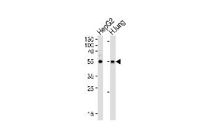 Western blot analysis of lysates from HepG2 cell line and human lung tissue lysate (from left to right), using ALDH1A1 Antibody at 1:1000 at each lane. (ALDH1A1 antibody)