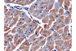 Immunohistochemistry (IHC) image for anti-Hypoxia Inducible Factor 1, alpha Subunit (Basic Helix-Loop-Helix Transcription Factor) (HIF1A) (AA 575-826) antibody (ABIN7432634)