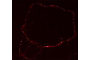 Immunolabeling of cultured hippocampus neurons (dilution 1 : 500). (MAL2 antibody  (AA 13-28))