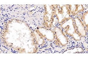 Detection of RPS6Kb1 in Human Kidney Tissue using Polyclonal Antibody to Ribosomal Protein S6 Kinase Beta 1 (RPS6Kb1) (RPS6KB1 antibody  (AA 91-352))