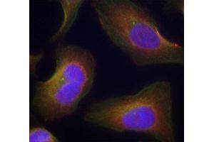 Immunofluorescence staining of methanol-fixed Hela cells using Phospho-PRKCQ-S676 antibody. (PKC theta antibody  (pSer676))