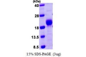 SDS-PAGE (SDS) image for Protein Phosphatase 3, Regulatory Subunit B, alpha (PPP3R1) (AA 1-170) protein (His tag) (ABIN666631) (PPP3R1 Protein (AA 1-170) (His tag))