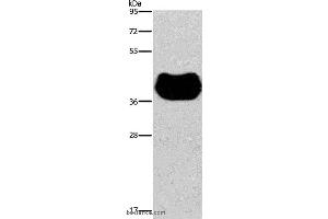 Western blot analysis of Human fetal muscle tissue, using HRH2 Polyclonal Antibody at dilution of 1:300 (HRH2 antibody)