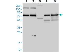 Western blot analysis of Lane 1: RT-4, Lane 2: U-251 MG, Lane 3: Human Plasma, Lane 4: Liver, Lane 5: Tonsil with TXLNA polyclonal antibody  at 1:250-1:500 dilution. (alpha Taxilin antibody)